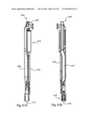 Spinous Process Fusion Implants and Insertion, Compression, and Locking     Instrumentation diagram and image