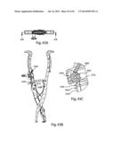 Spinous Process Fusion Implants and Insertion, Compression, and Locking     Instrumentation diagram and image