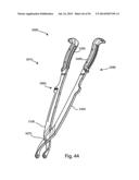 Spinous Process Fusion Implants and Insertion, Compression, and Locking     Instrumentation diagram and image