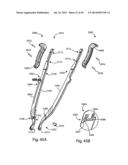 Spinous Process Fusion Implants and Insertion, Compression, and Locking     Instrumentation diagram and image