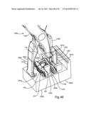 Spinous Process Fusion Implants and Insertion, Compression, and Locking     Instrumentation diagram and image