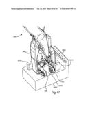 Spinous Process Fusion Implants and Insertion, Compression, and Locking     Instrumentation diagram and image