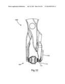 Spinous Process Fusion Implants and Insertion, Compression, and Locking     Instrumentation diagram and image