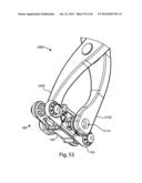 Spinous Process Fusion Implants and Insertion, Compression, and Locking     Instrumentation diagram and image