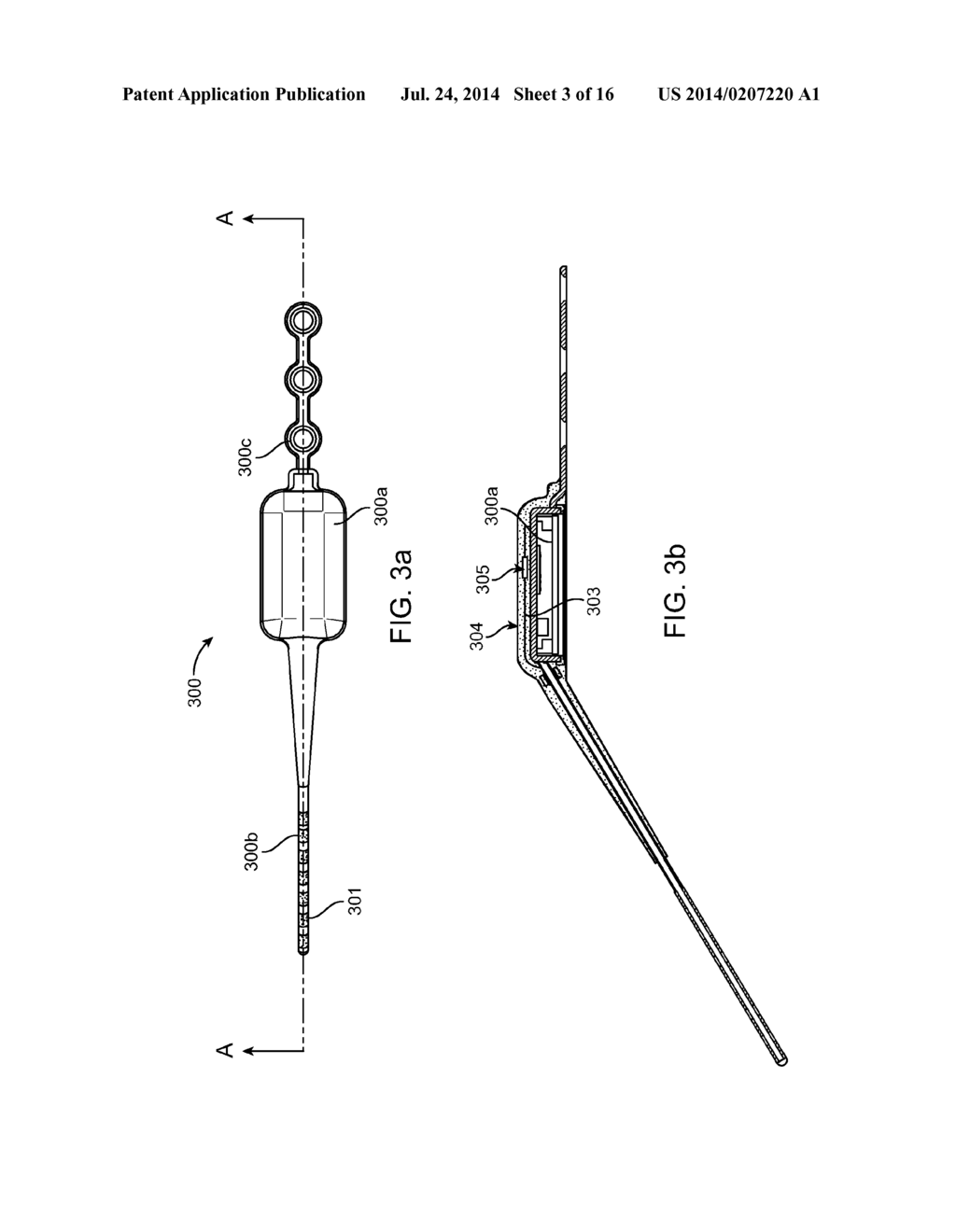 Implantable Neurostimulator with Integral Hermetic Electronic Enclosure,     Circuit Substrate, Monolithic Feed-Through, Lead Assembly and Anchoring     Mechanism - diagram, schematic, and image 04