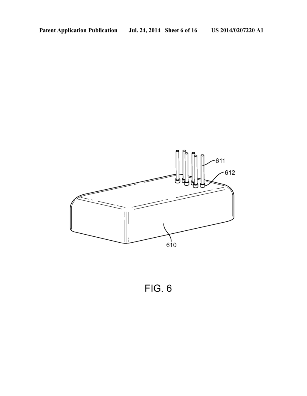 Implantable Neurostimulator with Integral Hermetic Electronic Enclosure,     Circuit Substrate, Monolithic Feed-Through, Lead Assembly and Anchoring     Mechanism - diagram, schematic, and image 07