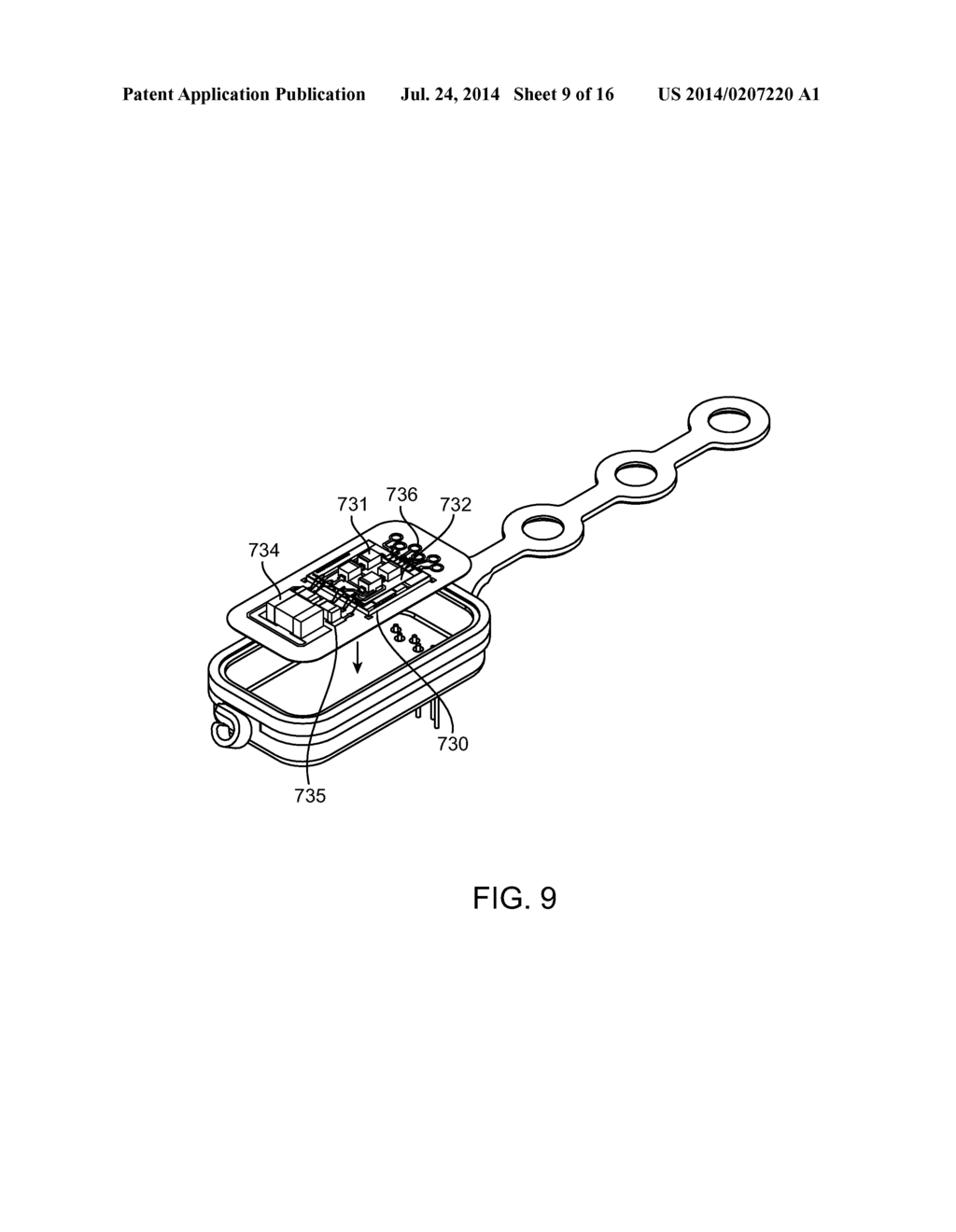 Implantable Neurostimulator with Integral Hermetic Electronic Enclosure,     Circuit Substrate, Monolithic Feed-Through, Lead Assembly and Anchoring     Mechanism - diagram, schematic, and image 10