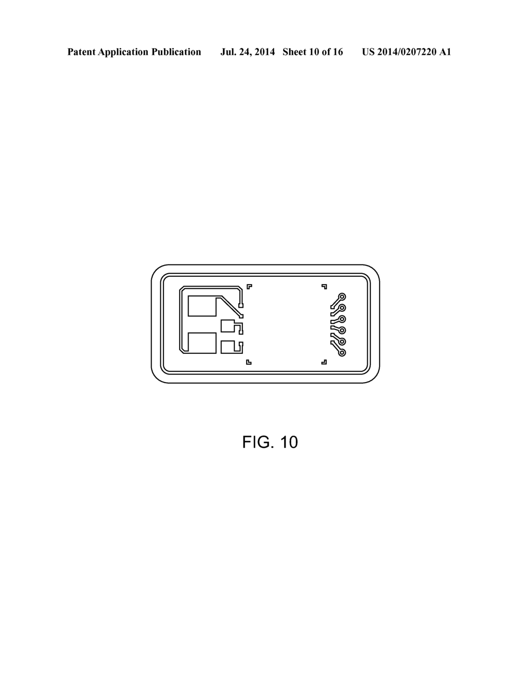 Implantable Neurostimulator with Integral Hermetic Electronic Enclosure,     Circuit Substrate, Monolithic Feed-Through, Lead Assembly and Anchoring     Mechanism - diagram, schematic, and image 11