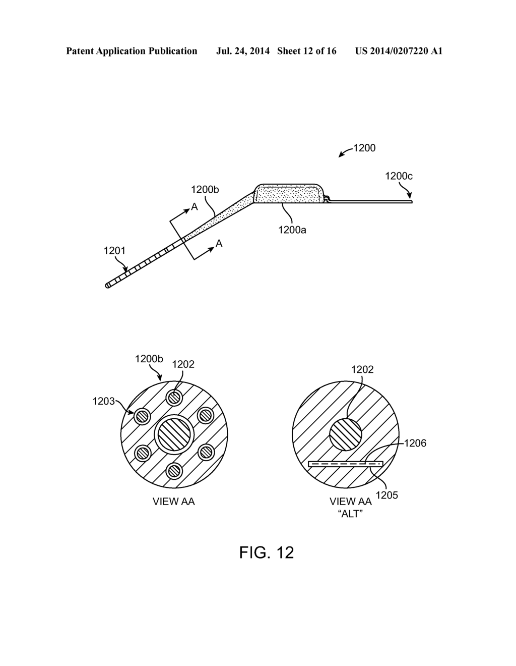 Implantable Neurostimulator with Integral Hermetic Electronic Enclosure,     Circuit Substrate, Monolithic Feed-Through, Lead Assembly and Anchoring     Mechanism - diagram, schematic, and image 13