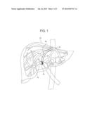 STENT WITH POSITIONING ARMS diagram and image