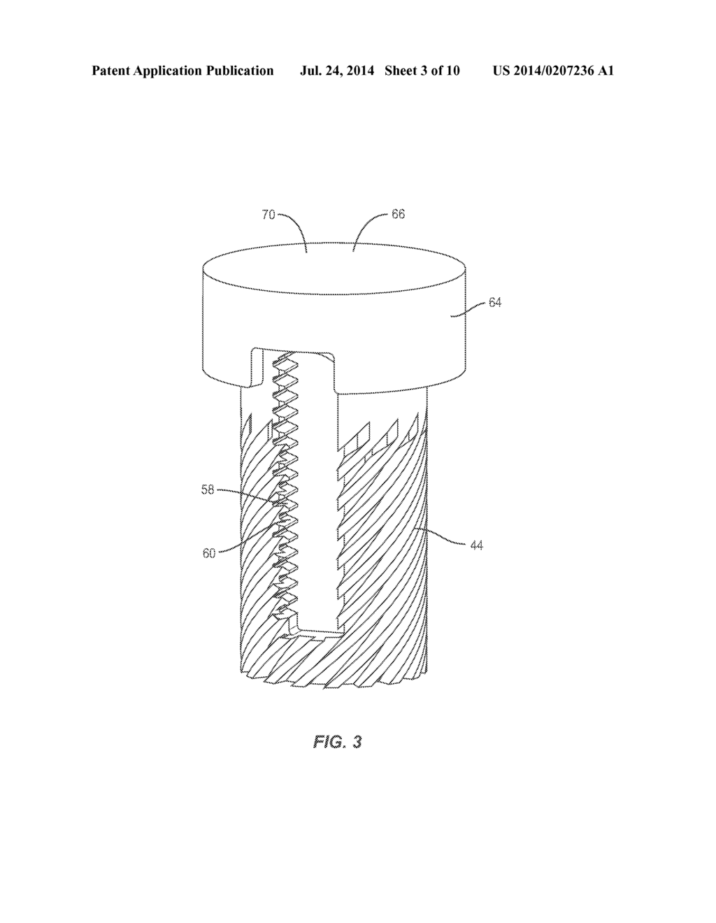 EXPANDABLE SPINAL IMPLANT SYSTEM AND METHOD - diagram, schematic, and image 04