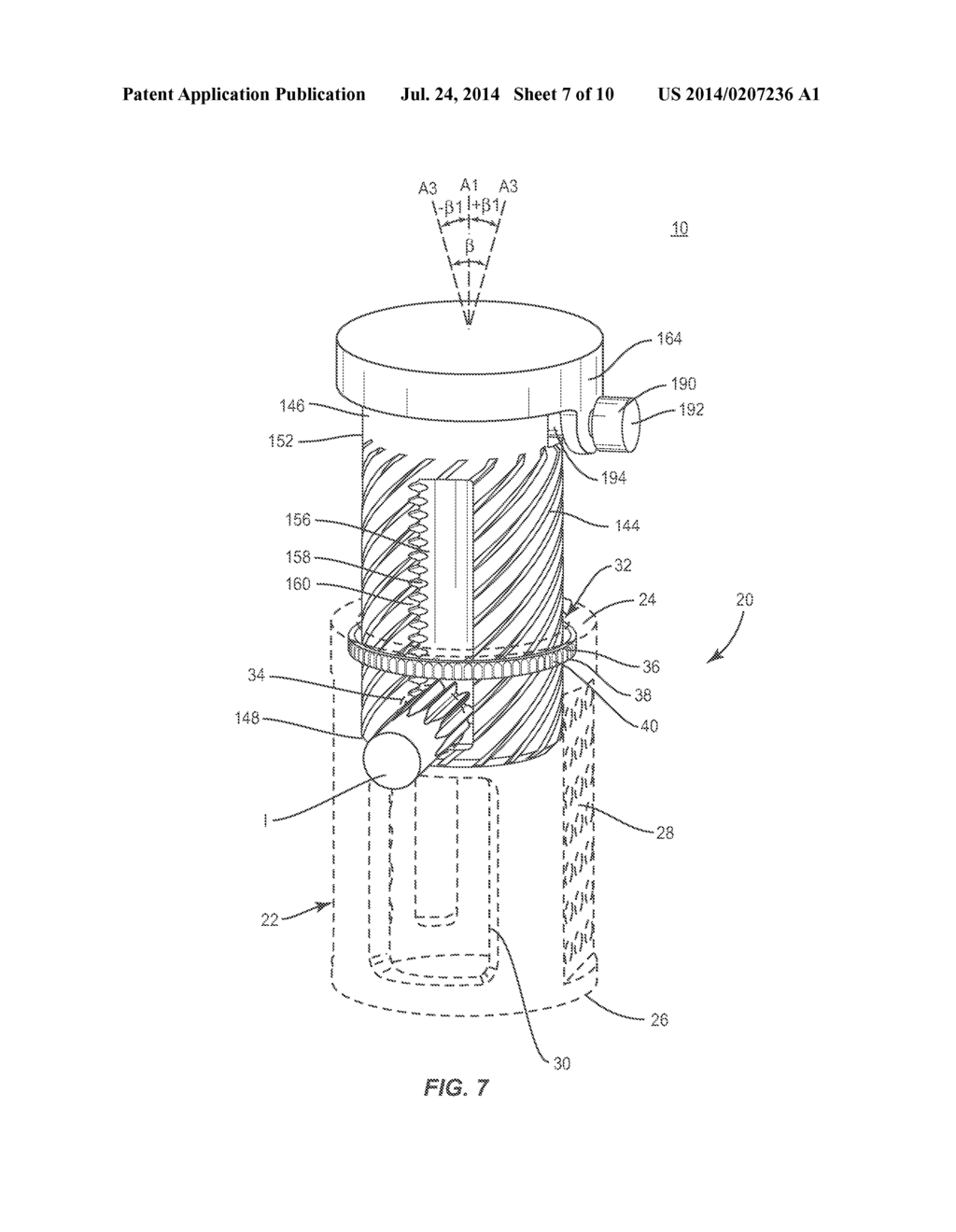 EXPANDABLE SPINAL IMPLANT SYSTEM AND METHOD - diagram, schematic, and image 08