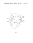 EXPANDABLE SPINAL IMPLANT SYSTEM AND METHOD diagram and image