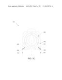 NON-PLANAR ORTHOPEDIC IMPLANTS AND METHODS diagram and image