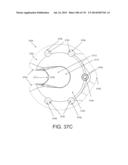 NON-PLANAR ORTHOPEDIC IMPLANTS AND METHODS diagram and image