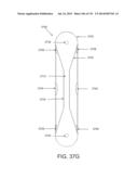 NON-PLANAR ORTHOPEDIC IMPLANTS AND METHODS diagram and image