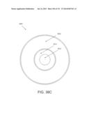 NON-PLANAR ORTHOPEDIC IMPLANTS AND METHODS diagram and image