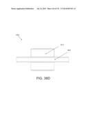 NON-PLANAR ORTHOPEDIC IMPLANTS AND METHODS diagram and image