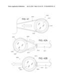 NON-PLANAR ORTHOPEDIC IMPLANTS AND METHODS diagram and image