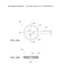 NON-PLANAR ORTHOPEDIC IMPLANTS AND METHODS diagram and image