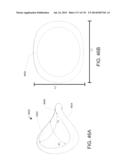 NON-PLANAR ORTHOPEDIC IMPLANTS AND METHODS diagram and image