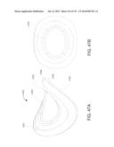 NON-PLANAR ORTHOPEDIC IMPLANTS AND METHODS diagram and image