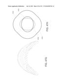 NON-PLANAR ORTHOPEDIC IMPLANTS AND METHODS diagram and image