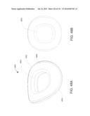 NON-PLANAR ORTHOPEDIC IMPLANTS AND METHODS diagram and image