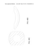 NON-PLANAR ORTHOPEDIC IMPLANTS AND METHODS diagram and image