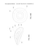 NON-PLANAR ORTHOPEDIC IMPLANTS AND METHODS diagram and image