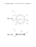 NON-PLANAR ORTHOPEDIC IMPLANTS AND METHODS diagram and image