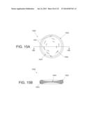 NON-PLANAR ORTHOPEDIC IMPLANTS AND METHODS diagram and image