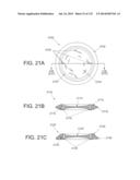 NON-PLANAR ORTHOPEDIC IMPLANTS AND METHODS diagram and image