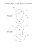 NON-PLANAR ORTHOPEDIC IMPLANTS AND METHODS diagram and image