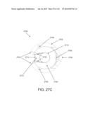 NON-PLANAR ORTHOPEDIC IMPLANTS AND METHODS diagram and image