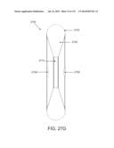 NON-PLANAR ORTHOPEDIC IMPLANTS AND METHODS diagram and image