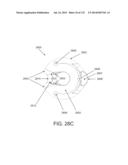 NON-PLANAR ORTHOPEDIC IMPLANTS AND METHODS diagram and image