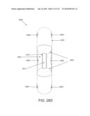 NON-PLANAR ORTHOPEDIC IMPLANTS AND METHODS diagram and image