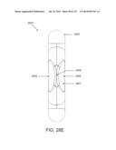 NON-PLANAR ORTHOPEDIC IMPLANTS AND METHODS diagram and image