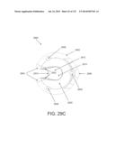 NON-PLANAR ORTHOPEDIC IMPLANTS AND METHODS diagram and image