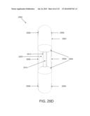 NON-PLANAR ORTHOPEDIC IMPLANTS AND METHODS diagram and image