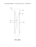 NON-PLANAR ORTHOPEDIC IMPLANTS AND METHODS diagram and image