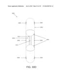 NON-PLANAR ORTHOPEDIC IMPLANTS AND METHODS diagram and image