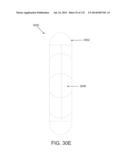 NON-PLANAR ORTHOPEDIC IMPLANTS AND METHODS diagram and image