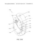 NON-PLANAR ORTHOPEDIC IMPLANTS AND METHODS diagram and image