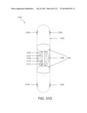 NON-PLANAR ORTHOPEDIC IMPLANTS AND METHODS diagram and image