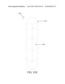 NON-PLANAR ORTHOPEDIC IMPLANTS AND METHODS diagram and image