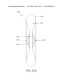 NON-PLANAR ORTHOPEDIC IMPLANTS AND METHODS diagram and image