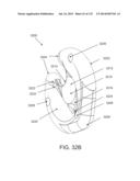 NON-PLANAR ORTHOPEDIC IMPLANTS AND METHODS diagram and image