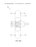 NON-PLANAR ORTHOPEDIC IMPLANTS AND METHODS diagram and image